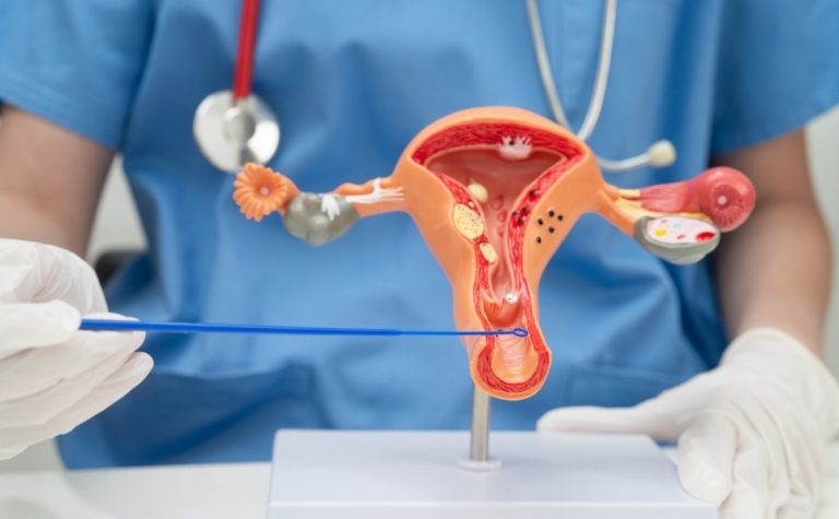Câncer de vulva e vagina mata quase 600 mulheres em 2025