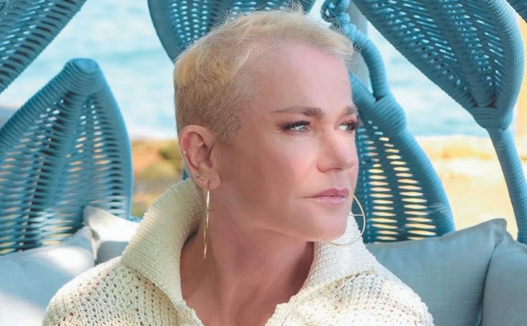 Estenose de canal: entenda as causas e tratamentos do problema que afeta Xuxa