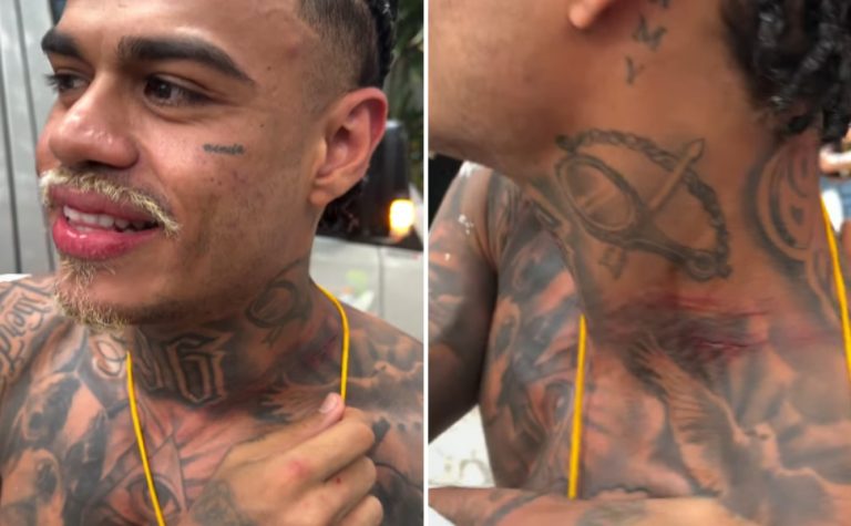 MC Cabelinho fica com pescoço machucado após tentativa de furto em Salvador