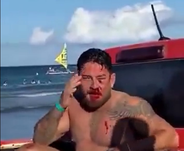 ‘Teve motivação homofóbica’, diz casal de turistas agredido em praia de Porto de Galinhas