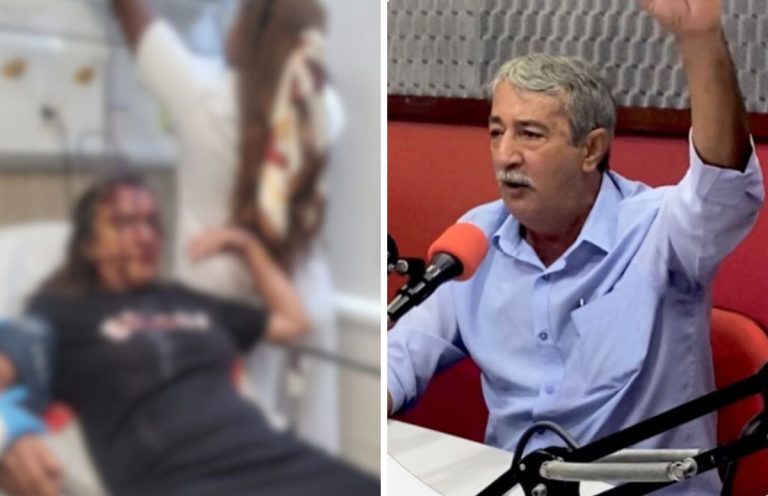 Vítima de ex-secretário corre risco de perder a visão após tentativa de feminicídio