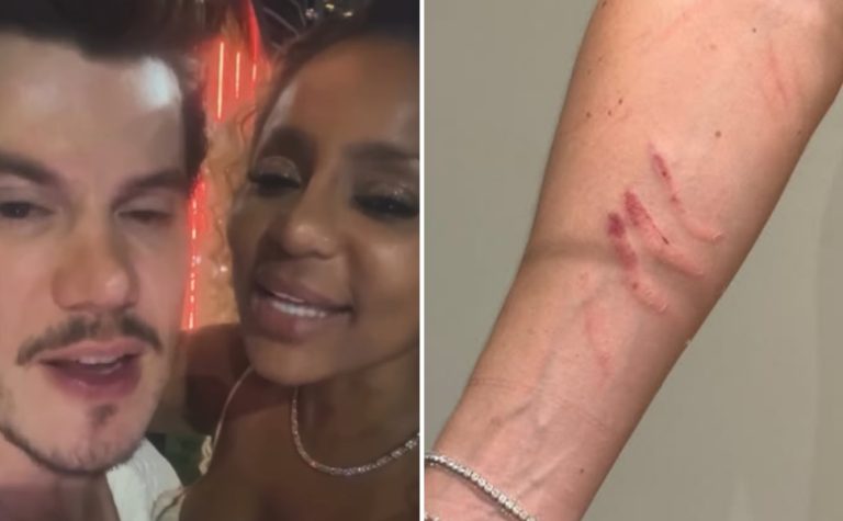 Cariúcha acusa médico de agressão; ele nega e afirma ter sido arranhado por ela