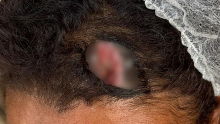 Mulher é resgatada de violência doméstica após denúncia anônima em Caruaru