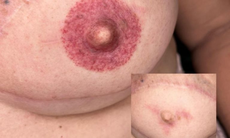 Projeto social leva tatuagem restauradora e ações de inclusão à Fenahall 2026
