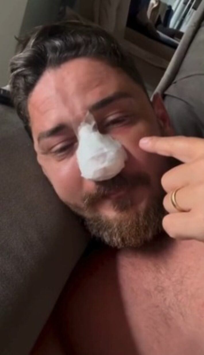 Turista agredido em Porto de Galinhas faz cirurgia para corrigir fraturas no rosto