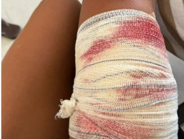 Turista de SP é mordida por tubarão ao mergulhar em Fernando de Noronha