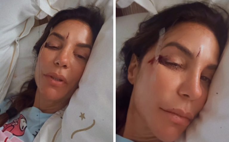 Ivete Sangalo é internada em Salvador após desmaio em casa