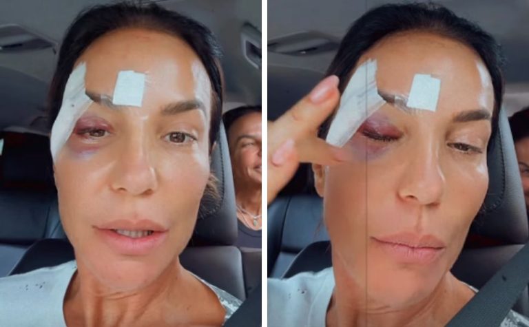 Ivete Sangalo recebe alta hospitalar e revela diagnóstico de síndrome vasovagal