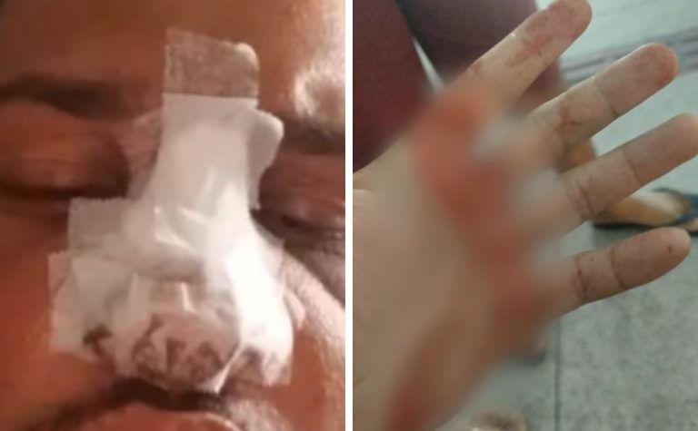 Jovem tem nariz quebrado após agressão dentro de coletivo em Vila Velha
