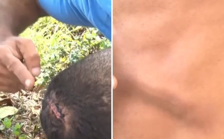 Turista diz ter sido espancado após questionar conta em quiosque de Vila Velha