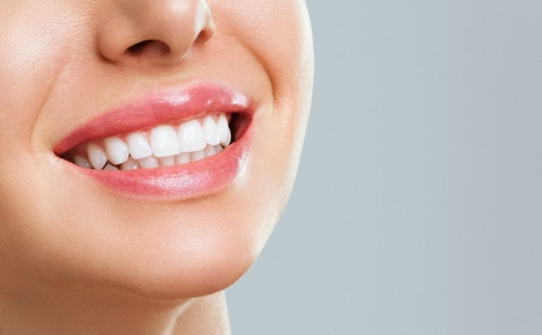 Anvisa manda recolher fitas para clareamento dental