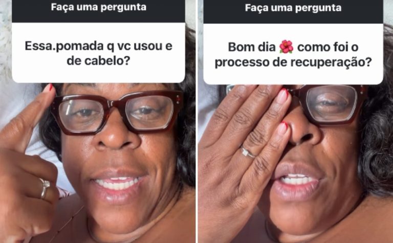Cacau Protásio volta a enxergar após cegueira temporária e faz alerta sobre produto