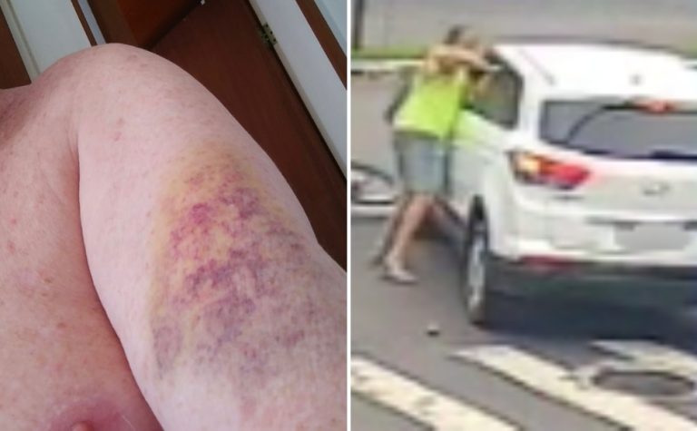 Dentista é indiciado após agredir idoso com socos em briga no trânsito em Vitória