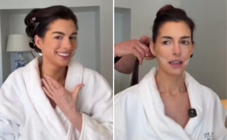 ‘Facelift’ sem cirurgia: Anne Hathaway revela truque que usou no Oscar 2026