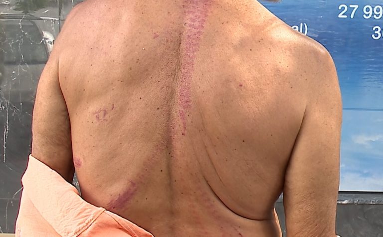 Idoso argentino é espancado e roubado na Serra