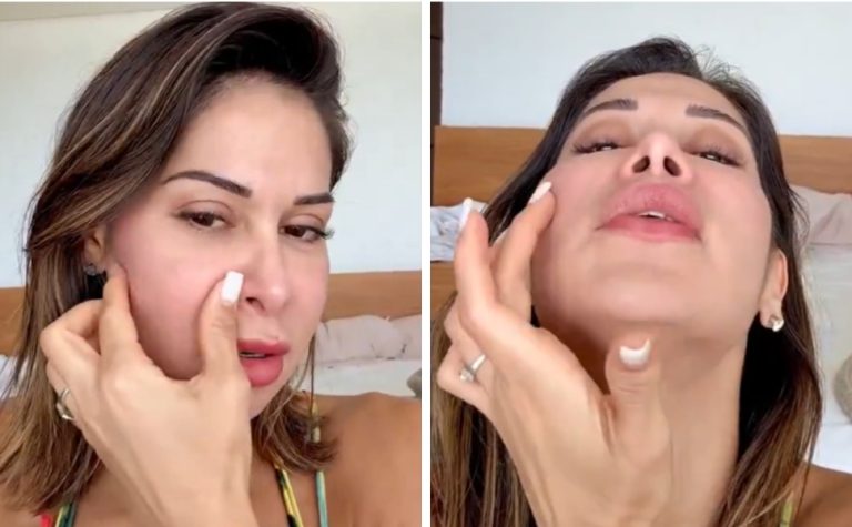 Maíra Cardi passará por cirurgia delicada após deformação no rosto