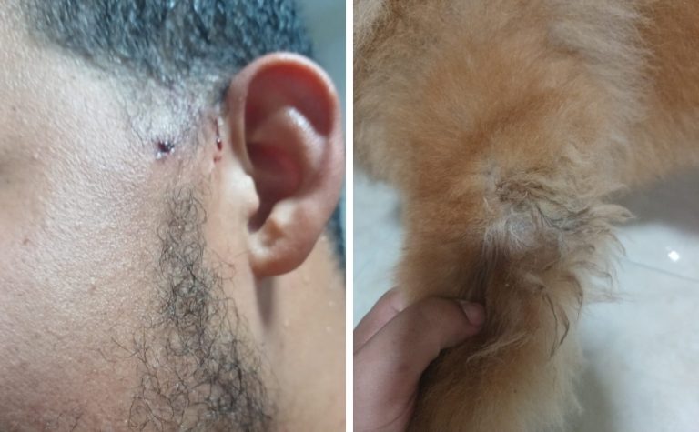 Pitbull ataca jovem e chow-chow duas vezes no Perocão, em Guarapari