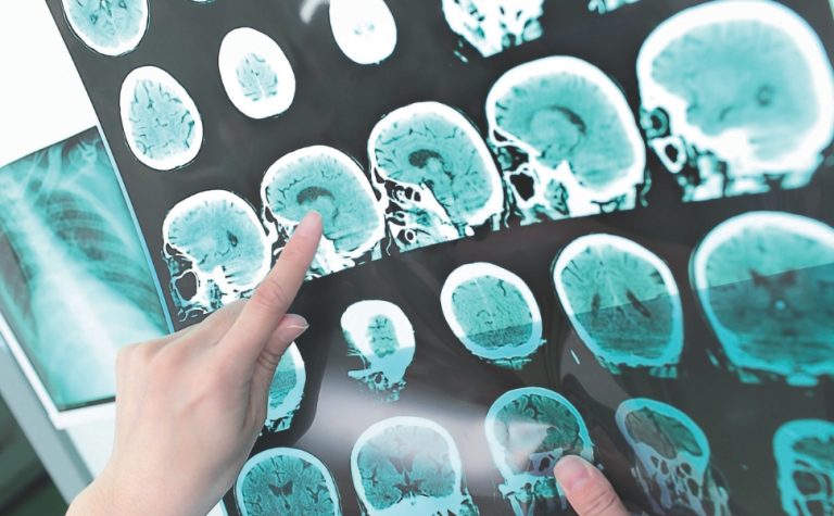 Avanços na medicina: estudos podem mudar diagnósticos no futuro