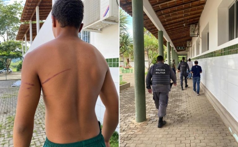 Estudante de 15 anos é agredido por colegas em internato no Noroeste do ES