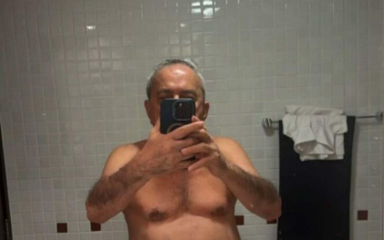 Ex-deputado Átila Lira (PI) publica nude e imagem viraliza em redes sociais