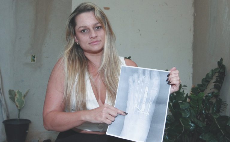 Sobreviventes de acidentes com motos lutam contra dores e depressão