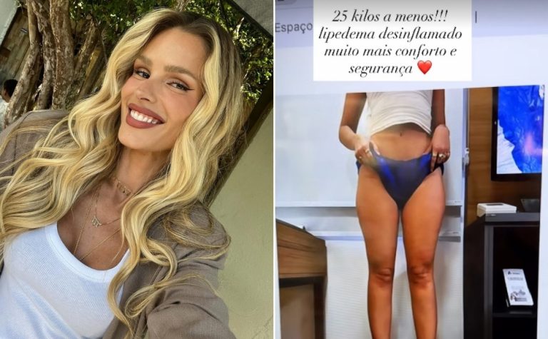 Yasmin Brunet revela ter perdido 25 kg em tratamento contra lipedema