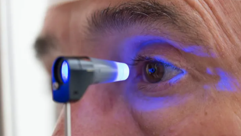 Glaucoma: mais de metade dos brasileiros está no grupo de risco