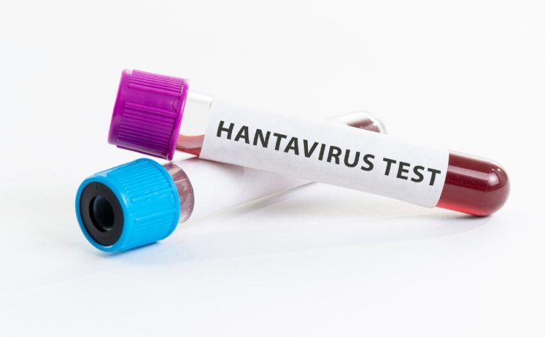 Hantavírus é comum em países como o Brasil e é transmitido por roedores silvestres
