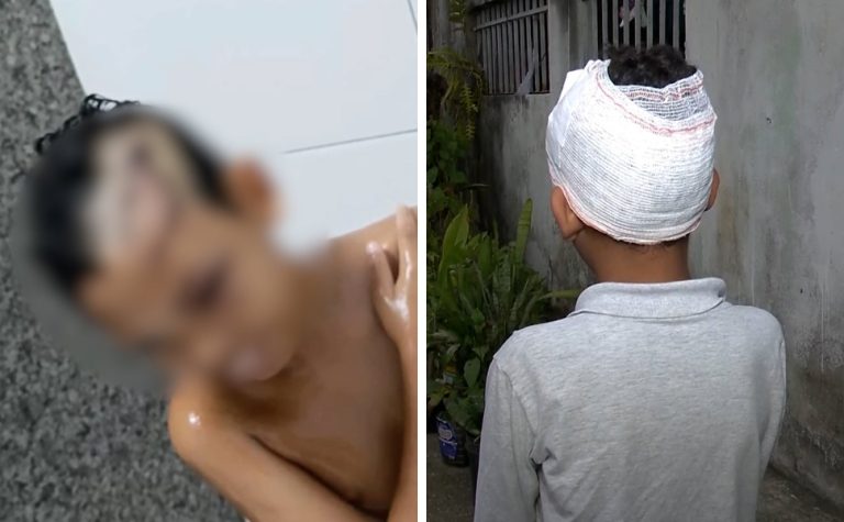 Menino de 8 anos é atacado por cachorro em Vila Velha e fica ferido