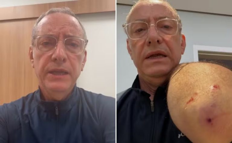 Jornalista José Roberto Burnier é atacado por pitbull: ‘irresponsabilidade’