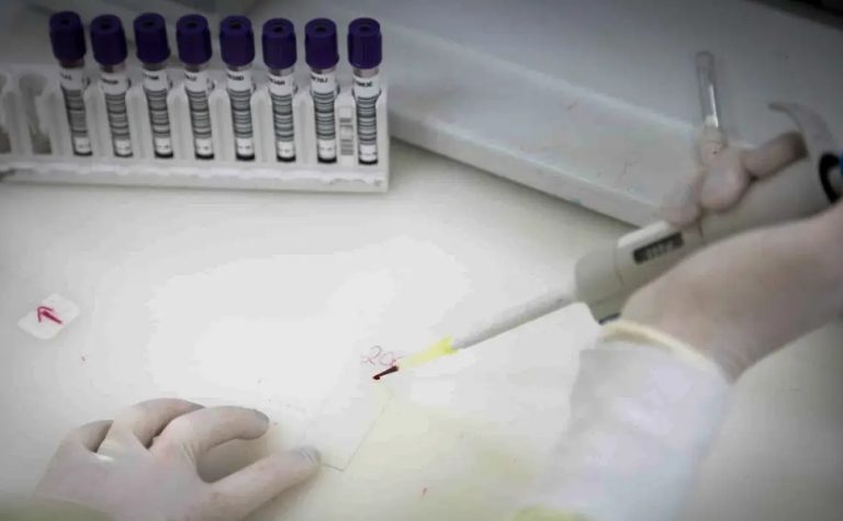 Secretaria de Saúde de SP investiga novo caso suspeito de ebola