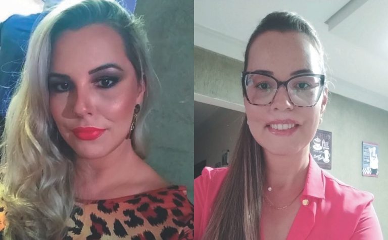 “Vivia 24 horas com muita dor”, conta influenciadora que recebeu aplicação de PMMA