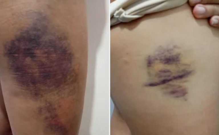 Jovem é espancada e bebê é ameaçado após suspeitos invadirem casa na Serra